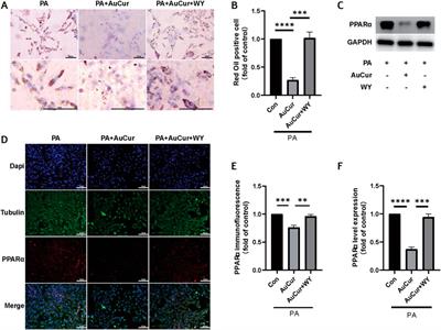 Curcumin Conjugated Gold Nanoclusters as Perspective Therapeutics for Diabetic Cardiomyopathy